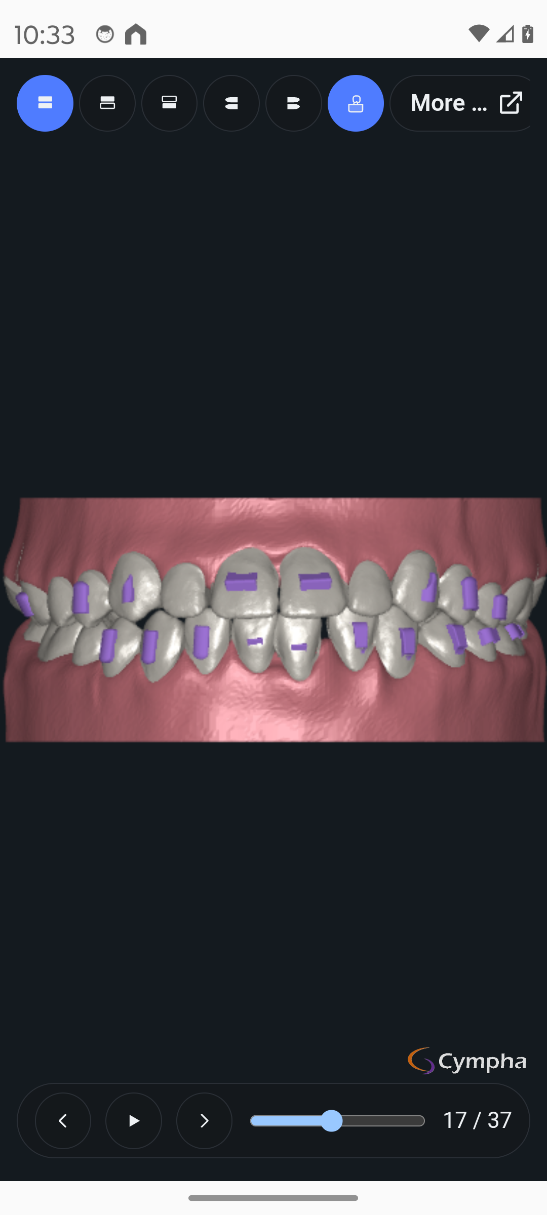 Stepping through a GuideMia case